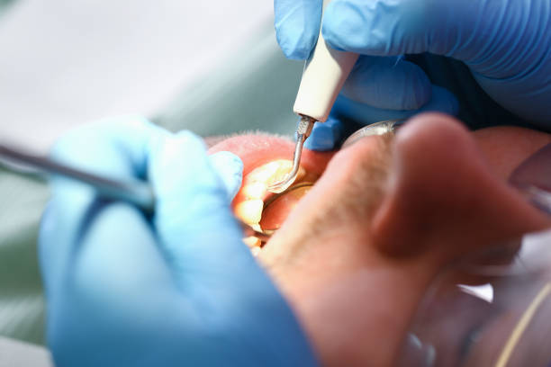 Best Mobile Emergency Dentist in Hearne, TX